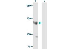 Lane 1: AKAP13 transfected lysate ( 120. (AKAP13 293T Cell Transient Overexpression Lysate(Denatured))