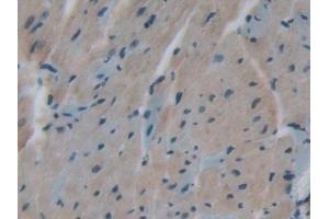 Immunohistochemistry (IHC) image for anti-Transferrin Receptor 2 (TFR2) (AA 86-259) antibody (ABIN7431467)