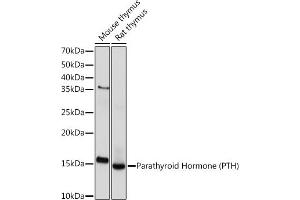 Western blot analysis of extracts of various cell lines, using Parathyroid Hormone (PTH) (PTH) Rabbit mAb (ABIN7269175) at 1:1000 dilution. (PTH 抗体)