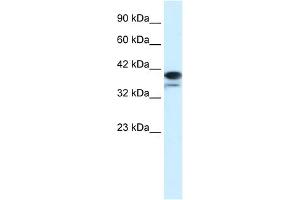 WB Suggested Anti-PAntibody Titration:  1. (PARP6 抗体  (N-Term))
