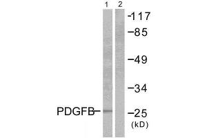 Western Blotting (WB) image for anti-Platelet Derived Growth Factor Subunit B (PDGFB) (Internal Region) antibody (ABIN1848736) (PDGFB 抗体  (Internal Region))