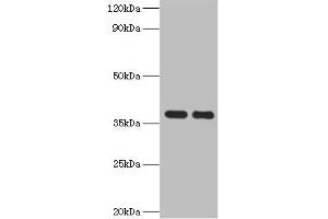 Western blot All lanes: GALM antibody at 2 μg/mL Lane 1: Mouse kidney tissue Lane 2: Rat adrenal gland tissue Secondary Goat polyclonal to rabbit IgG at 1/10000 dilution Predicted band size: 38 kDa Observed band size: 38 kDa (GALM 抗体  (AA 2-342))