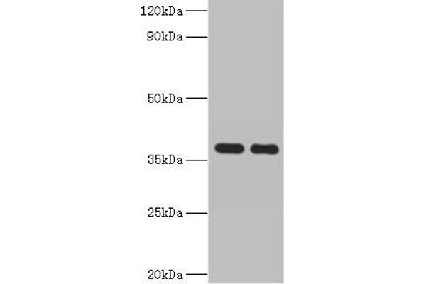 GALM 抗体  (AA 2-342)