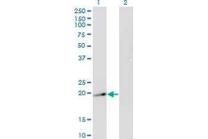 Western Blot analysis of TWIST2 expression in transfected 293T cell line by TWIST2 monoclonal antibody (M20A), clone 3B2.