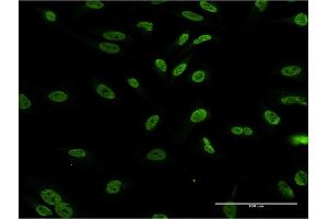 Immunofluorescence of monoclonal antibody to DLX1 on HeLa cell. (DLX1 抗体  (AA 152-255))