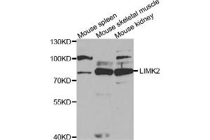 Western Blotting (WB) image for anti-LIM Domain Kinase 2 (LIMK2) antibody (ABIN1876597) (LIMK2 抗体)