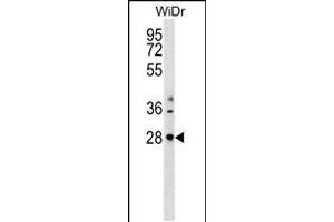 Western blot analysis in WiDr cell line lysates (35ug/lane). (THAP10 抗体  (N-Term))