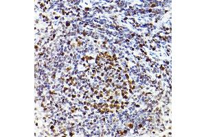 Immunohistochemistry (IHC) image for anti-Minichromosome Maintenance Complex Component 2 (MCM2) antibody (ABIN7268538)