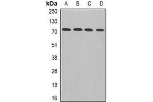 Western blot analysis of ADAM33 expression in Hela (A), MCF7 (B), mouse brain (C), rat heart (D) whole cell lysates. (ADAM33 抗体)