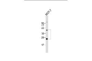 Anti-HABP2 Antibody (C-term) at 1:2000 dilution + MCF-7 whole cell lysate Lysates/proteins at 20 μg per lane. (HABP2 抗体  (C-Term))