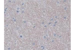 Detection of UNG in Human Cerebrum Tissue using Polyclonal Antibody to Uracil DNA Glycosylase (UNG)