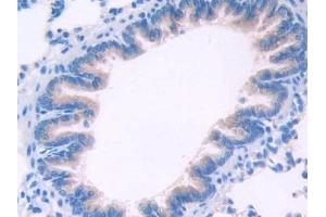 Immunohistochemistry (IHC) image for anti-Klotho beta (KLB) (AA 380-506) antibody (ABIN7438571)