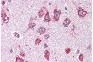 Immunohistochemistry (IHC) image for anti-Activin Receptor Type 1C (ACVR1C) (N-Term) antibody (ABIN1099825)