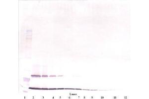 Image no. 3 for anti-Thymic Stromal Lymphopoietin (TSLP) antibody (ABIN465621) (Thymic Stromal Lymphopoietin 抗体)