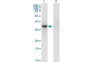 Western Blot analysis of BRMS1 expression in transfected 293T cell line by BRMS1 monoclonal antibody (M01), clone 2D4-2G11.