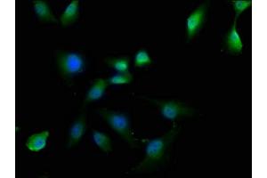 Immunofluorescence staining of U251 cells with ABIN7162330 at 1:50, counter-stained with DAPI. (OTUD3 抗体  (AA 108-398))