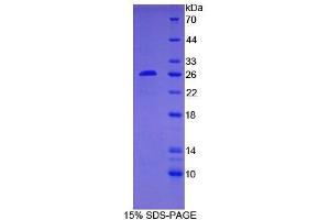 SDS-PAGE of Protein Standard from the Kit (Highly purified E. (Bcl-2 ELISA 试剂盒)