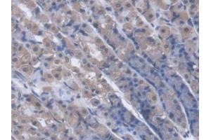DAB staining on IHC-P; Samples: Rat Stomach Tissue (PNP 抗体  (AA 1-289))
