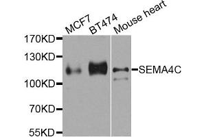 Western Blotting (WB) image for anti-Sema Domain, Immunoglobulin Domain (Ig), Transmembrane Domain (TM) and Short Cytoplasmic Domain, (Semaphorin) 4C (SEMA4C) antibody (ABIN2737519)