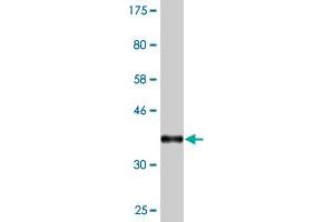 Western Blot detection against Immunogen (37. (ZBTB25 抗体  (AA 331-435))