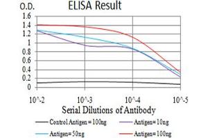 Black line: Control Antigen (100 ng), Purple line: Antigen(10 ng), Blue line: Antigen (50 ng), Red line: Antigen (100 ng), (Estrogen Receptor alpha 抗体  (pTyr537))