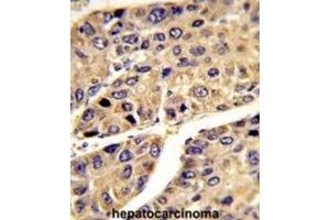 Immunohistochemistry (IHC) image for anti-Insulin-Like Growth Factor Binding Protein, Acid Labile Subunit (IGFALS) antibody (ABIN3003239) (IGFALS 抗体)