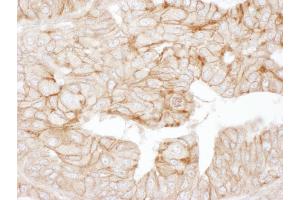 Immunohistochemistry (IHC) image for anti-Adducin 1 (Alpha) (ADD1) (AA 550-600) antibody (ABIN7453420)