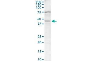 BAAT monoclonal antibody (M03), clone 1E4. (BAAT 抗体  (AA 258-355))