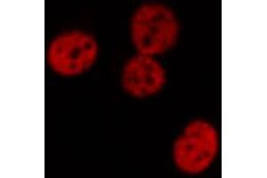 Immunofluorescence (fixed cells) (IF/ICC) image for anti-Signal Transducer and Activator of Transcription 1, 91kDa (STAT1) (pTyr701) antibody (ABIN6255991)