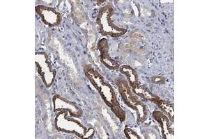 Immunohistochemical staining of human kidney with TMEM72 polyclonal antibody  shows strong cytoplasmic positivity in tubular cells at 1:200-1:500 dilution.