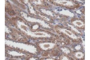 Detection of NME5 in Human Kidney Tissue using Polyclonal Antibody to Non Metastatic Cells 5, Protein NM23A Expressed In (NME5) (NME5 抗体  (AA 3-194))