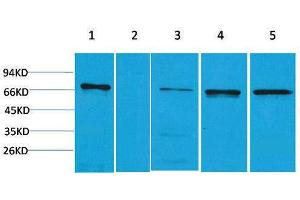 Western Blotting (WB) image for anti-Zinc Finger and BTB Domain Containing 45 (ZBTB45) antibody (ABIN3179016) (ZBTB45 抗体)