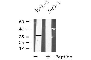Western blot analysis of PPP2CA using Jurkat whole cell lysates