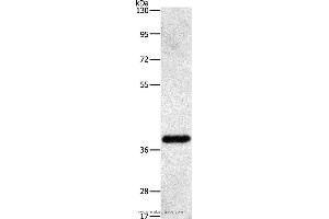 Western blot analysis of Human fetal liver tissue, using PRKAG1 Polyclonal Antibody at dilution of 1:500 (PRKAG1 抗体)