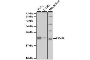 Western blot analysis of extracts of various cell lines, using PSMB9 antibody. (PSMB9 抗体)