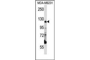 Western blot analysis of PITRM1 Antibody (Center) in MDA-MB231 cell line lysates (35ug/lane).