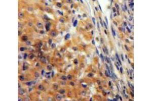 IHC-P analysis of Ovary tissue, with DAB staining. (KNG1 抗体  (AA 390-644))
