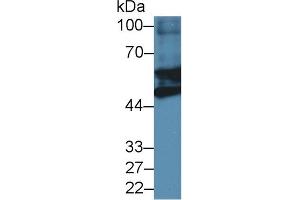 Detection of GFAP in Mouse Heart lysate using Polyclonal Antibody to Glial Fibrillary Acidic Protein (GFAP) (GFAP 抗体  (AA 253-354))