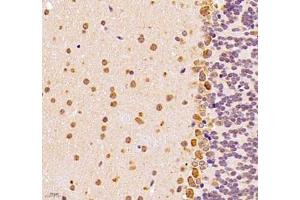 Immunohistochemistry of paraffin embedded mouse epencephalon using UQCC (ABIN7076094) at dilution of 1: 1000 (400x lens) (Ubiquinol-Cytochrome C Reductase Complex Chaperone (UQCC) 抗体)
