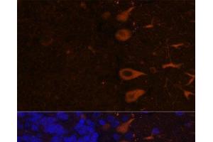 Immunofluorescence analysis of Rat brain using KAL1 Polyclonal Antibody at dilution of 1:100. (KAL1 抗体)