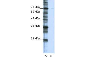 Western Blotting (WB) image for anti-Cleavage Stimulation Factor, 3' Pre-RNA, Subunit 2, 64kDa, tau Variant (CSTF2T) (C-Term) antibody (ABIN2779080)