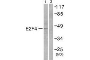 Western blot analysis of extracts from COS7 cells, using E2F4 Antibody. (E2F4 抗体  (AA 51-100))