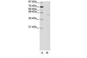 Image no. 1 for anti-PiggyBac Transposable Element Derived 1 (PGBD1) (AA 721-770) antibody (ABIN202922) (PGBD1 抗体  (AA 721-770))