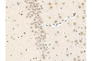 ABIN7094823 and ABIN7098874 at 1/100 staining Rat brain tissue by IHC-P. (MAML2 抗体  (C-Term))