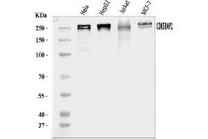 Western blot analysis of CDK5RAP2 using anti-CDK5RAP2 antibody (ABIN7600238).