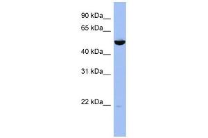 MAP2K7 antibody used at 1 ug/ml to detect target protein. (MAP2K7 抗体  (Middle Region))