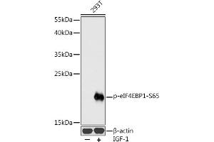 Western blot analysis of extracts of 293T cells, using Phospho-eIF4EBP1-S65 antibody (ABIN3023531, ABIN3023532, ABIN3023533 and ABIN6225390) at 1:1000 dilution. (eIF4EBP1 抗体  (pSer65))
