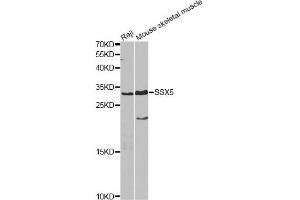 Western blot analysis of extracts of various cell lines, using SSX5 antibody. (SSX5 抗体)