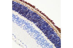 Immunohistochemistry of paraffin-embedded mouse retina using PDE6B antibody (ABIN6132473, ABIN6145363, ABIN6145364 and ABIN6222688) at dilution of 1:200 (40x lens). (PDE6B 抗体  (AA 1-190))