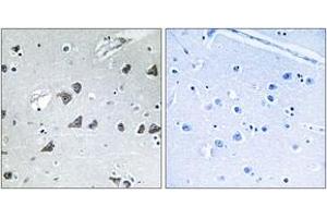 Immunohistochemistry analysis of paraffin-embedded human brain tissue, using EIF3F Antibody. (EIF3F 抗体  (AA 81-130))